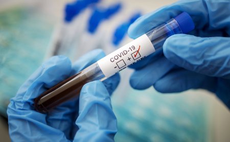 За минувшие сутки в Оренбургской области коронавирусом заболели более двух тысяч человек.